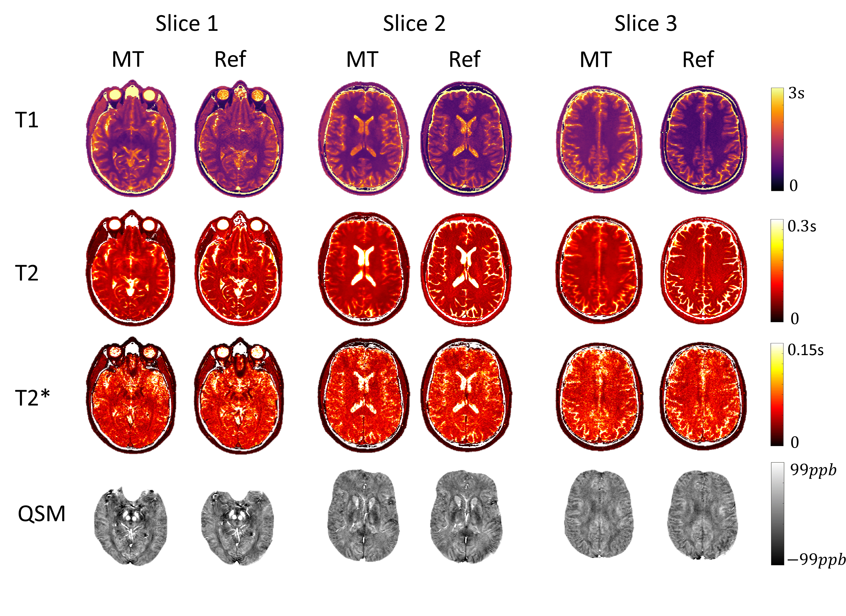 Brain Mapping